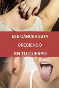 19 señales de advertencia de que el cáncer está creciendo en su cuerpo