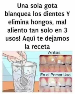 Quita el sarro de tus dientes y blanquéalos: Receta Casera Infalible.