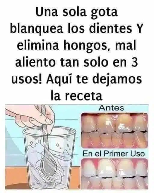Quita el sarro de tus dientes y blanquéalos: Receta Casera Infalible.