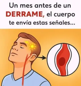 Señales de Advertencia de un Derrame Cerebral: 5 Síntomas que Preceden al Evento.