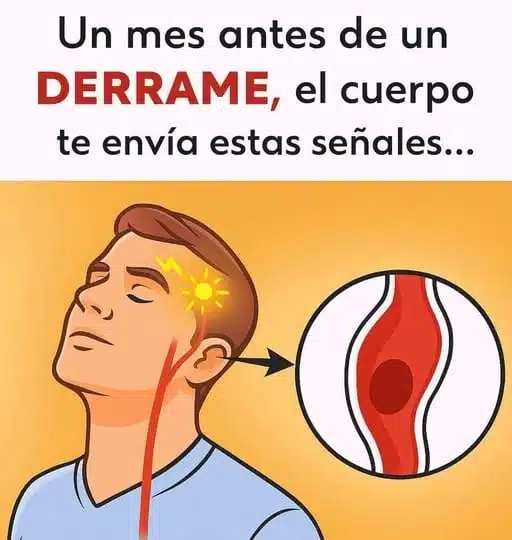 Señales de Advertencia de un Derrame Cerebral: 5 Síntomas que Preceden al Evento.