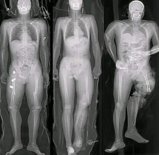 Importante Lo que debes saber si te pusiste la vacuna