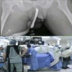 Una joven hospitalizada tras tener rela descubre que padece endometriosis